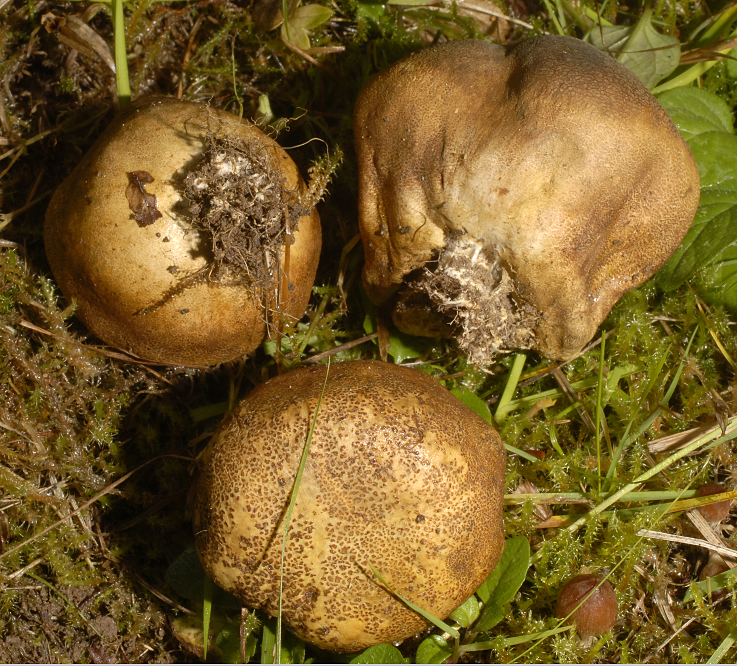 20072013093925 1144 art 1029 7027 scleroderma areolatum e57